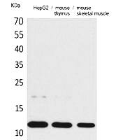 Fig. Western Blot analysis of HepG2,  Mouse thymus, Mouse skeletal muscle cells using Eotaxin Polyclonal Antibody. Secondary antibody (catalog#: A21020) was diluted at 1:20000.