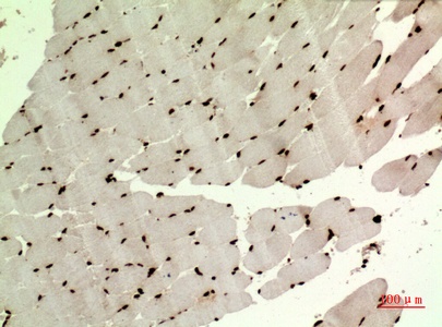 Fig.2. Immunohistochemical analysis of paraffin-embedded human-muscle, antibody was diluted at 1:100.