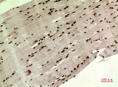 Fig.3. Immunohistochemical analysis of paraffin-embedded human-muscle, antibody was diluted at 1:100.