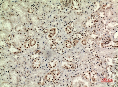 Fig.5. Immunohistochemical analysis of paraffin-embedded human-kidney, antibody was diluted at 1:100.