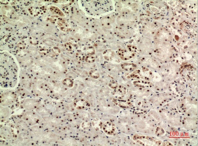 Fig.6. Immunohistochemical analysis of paraffin-embedded human-kidney, antibody was diluted at 1:100.