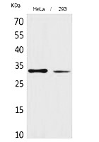 Fig.1. Western Blot analysis of hela, 293 cells using SDHB Polyclonal Antibody. Secondary antibody (catalog#: A21020) was diluted at 1:20000.