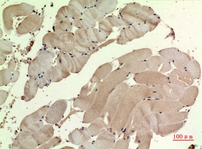 Fig.2. Immunohistochemical analysis of paraffin-embedded human-muscle, antibody was diluted at 1:100.