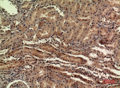 Fig.4. Immunohistochemical analysis of paraffin-embedded human-kidney, antibody was diluted at 1:100.