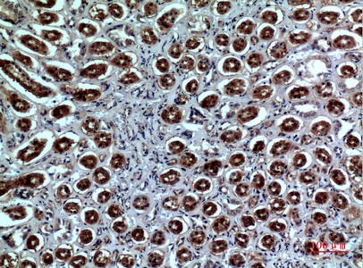 Fig.3. Immunohistochemical analysis of paraffin-embedded human-kidney, antibody was diluted at 1:100.