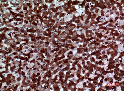 Fig.2. Immunohistochemical analysis of paraffin-embedded human-liver, antibody was diluted at 1:100.