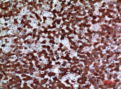 Fig.3. Immunohistochemical analysis of paraffin-embedded human-liver, antibody was diluted at 1:100.