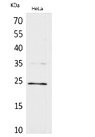 Fig.1. Western Blot analysis of hela cells using Rab 5A Polyclonal Antibody. Secondary antibody (catalog#: A21020) was diluted at 1:20000.