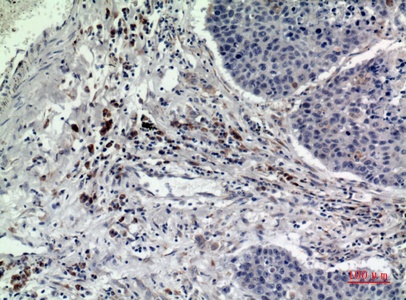 Fig.2. Immunohistochemical analysis of paraffin-embedded human-lung, antibody was diluted at 1:100.
