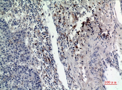 Fig.3. Immunohistochemical analysis of paraffin-embedded human-lung, antibody was diluted at 1:100.