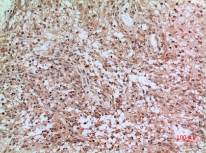 Fig.3. Immunohistochemical analysis of paraffin-embedded human-brain, antibody was diluted at 1:100.