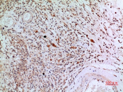 Fig.4. Immunohistochemical analysis of paraffin-embedded human-brain, antibody was diluted at 1:100.