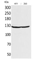 Fig.1. Western Blot analysis of 4T1,  293 cells using Integrin αD Polyclonal Antibody. Secondary antibody (catalog#: A21020) was diluted at 1:20000.
