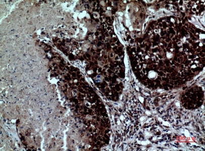 Fig.2. Immunohistochemical analysis of paraffin-embedded human-lung, antibody was diluted at 1:100.