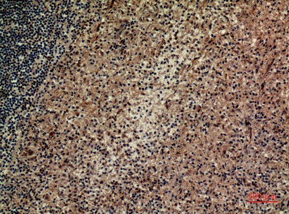 Fig.3. Immunohistochemical analysis of paraffin-embedded human-spleen, antibody was diluted at 1:100.