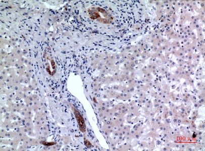 Fig.2. Immunohistochemical analysis of paraffin-embedded human-liver, antibody was diluted at 1:100.
