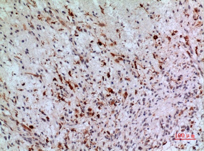 Fig.4. Immunohistochemical analysis of paraffin-embedded human-brain, antibody was diluted at 1:100.