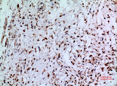 Fig.5. Immunohistochemical analysis of paraffin-embedded human-brain, antibody was diluted at 1:100.
