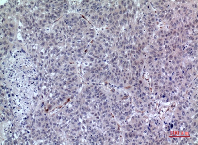 Fig.2. Immunohistochemical analysis of paraffin-embedded human-lung, antibody was diluted at 1:100.