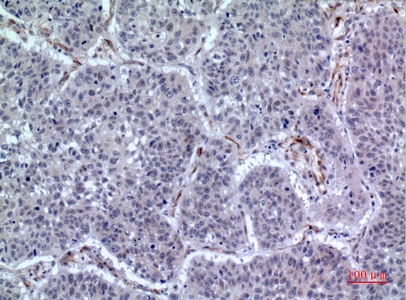 Fig.3. Immunohistochemical analysis of paraffin-embedded human-lung, antibody was diluted at 1:100.