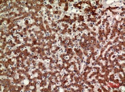 Fig.2. Immunohistochemical analysis of paraffin-embedded human-liver, antibody was diluted at 1:100.