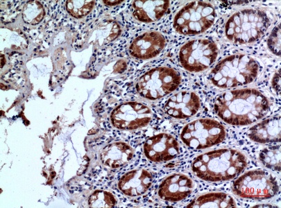Fig.4. Immunohistochemical analysis of paraffin-embedded human-colon, antibody was diluted at 1:100.