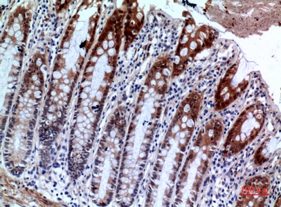 Fig.5. Immunohistochemical analysis of paraffin-embedded human-colon, antibody was diluted at 1:100.