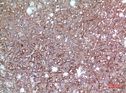 Fig.3. Immunohistochemical analysis of paraffin-embedded human-liver, antibody was diluted at 1:100.