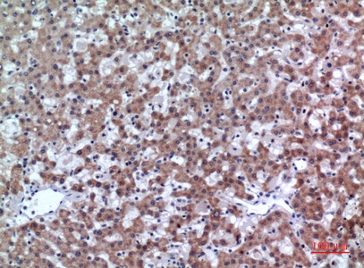 Fig.2. Immunohistochemical analysis of paraffin-embedded human-liver, antibody was diluted at 1:100.