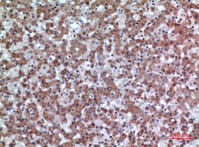 Fig.3. Immunohistochemical analysis of paraffin-embedded human-liver, antibody was diluted at 1:100.