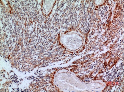 Fig.4. Immunohistochemical analysis of paraffin-embedded human-brain, antibody was diluted at 1:100.