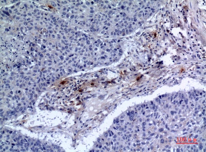 Fig.2. Immunohistochemical analysis of paraffin-embedded human-lung, antibody was diluted at 1:100.