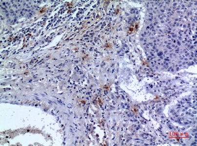 Fig.3. Immunohistochemical analysis of paraffin-embedded human-lung, antibody was diluted at 1:100.