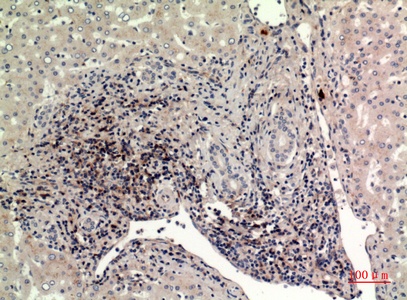 Fig.2. Immunohistochemical analysis of paraffin-embedded human-liver, antibody was diluted at 1:100.