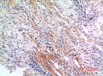 Fig.4. Immunohistochemical analysis of paraffin-embedded human-brain, antibody was diluted at 1:100.