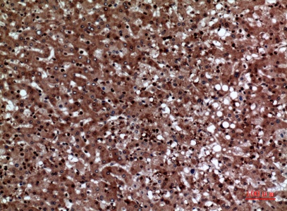 Fig.3. Immunohistochemical analysis of paraffin-embedded human-liver, antibody was diluted at 1:100.