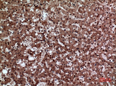 Fig.4. Immunohistochemical analysis of paraffin-embedded human-liver, antibody was diluted at 1:100.