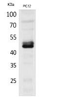 Fig.1. Western Blot analysis of PC-12 cells using NKp44 Polyclonal Antibody. Secondary antibody (catalog#: A21020) was diluted at 1:20000.