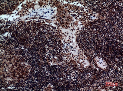Fig.2. Immunohistochemical analysis of paraffin-embedded human-Lymph-nodes, antibody was diluted at 1:100.