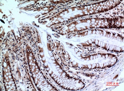 Fig.3. Immunohistochemical analysis of paraffin-embedded human-colon, antibody was diluted at 1:100.
