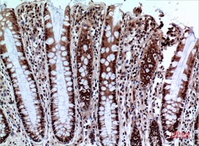 Fig.4. Immunohistochemical analysis of paraffin-embedded human-colon, antibody was diluted at 1:100.