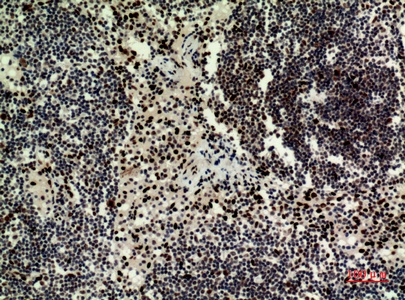 Fig.2. Immunohistochemical analysis of paraffin-embedded human-Lymph-nodes, antibody was diluted at 1:100.