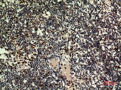 Fig.3. Immunohistochemical analysis of paraffin-embedded human-Lymph-nodes, antibody was diluted at 1:100.