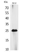 Fig.1. Western Blot analysis of PC12 cells using CMTM5 Polyclonal Antibody. Secondary antibody (catalog#: A21020) was diluted at 1:20000.
