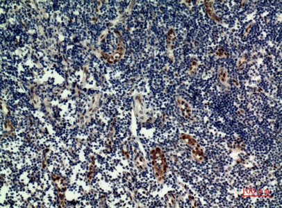 Fig.2. Immunohistochemical analysis of paraffin-embedded human-tonsilla, antibody was diluted at 1:100.