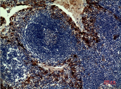 Fig.3. Immunohistochemical analysis of paraffin-embedded human-tonsilla, antibody was diluted at 1:100.
