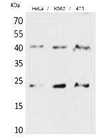 Fig.1. Western Blot analysis of hela, K562,  4T1 cells using TMEM173 Polyclonal Antibody. Secondary antibody (catalog#: A21020) was diluted at 1:20000.
