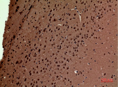 Fig.2. Immunohistochemical analysis of paraffin-embedded Mouse-brain, antibody was diluted at 1:100.