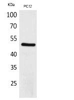 Fig.1. Western Blot analysis of PC12 cells using CRF-RI Polyclonal Antibody. Secondary antibody (catalog#: A21020) was diluted at 1:20000.