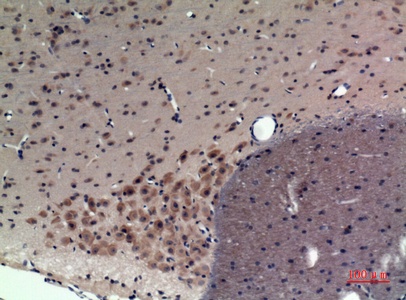 Fig.2. Immunohistochemical analysis of paraffin-embedded rat-brain, antibody was diluted at 1:100.